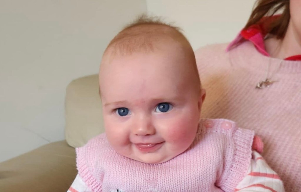 The postpartum surprises